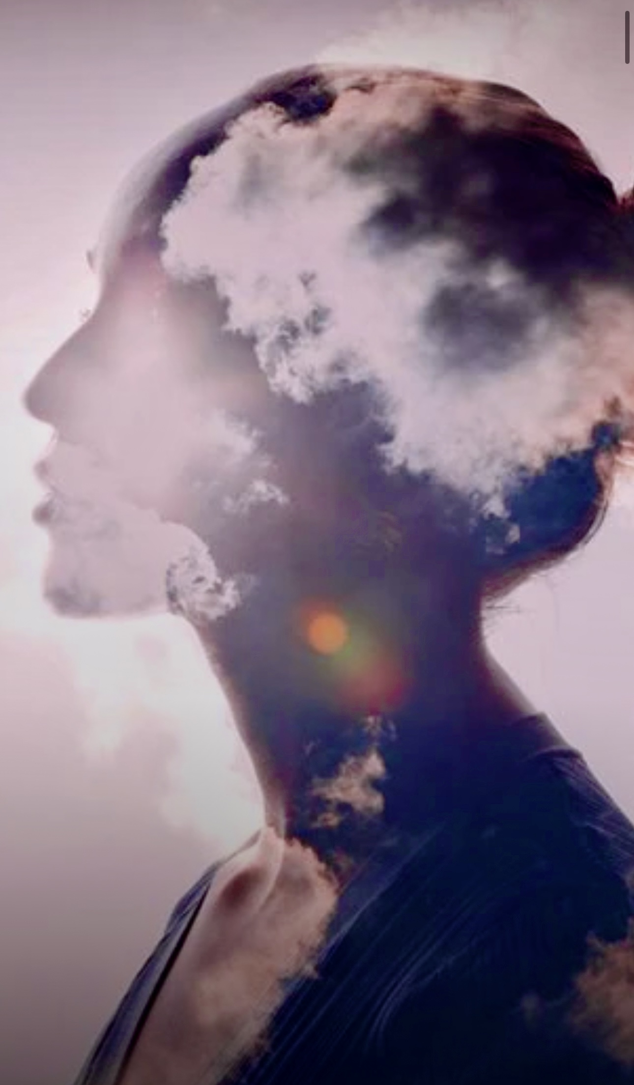 Alzheimer, donne discriminate nella diagnosi. AI abbatte gap