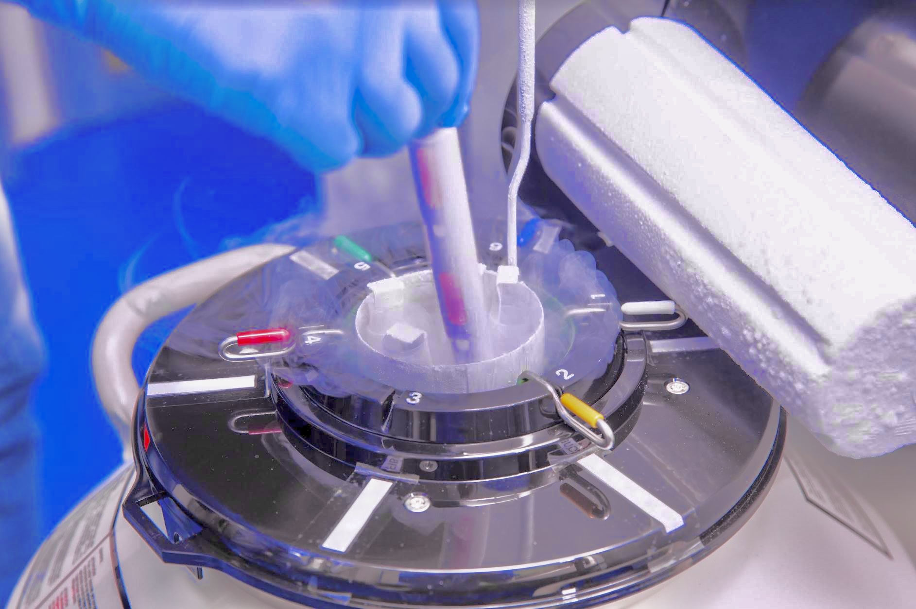 Fertilità: sempre più donne adottano il Social Freezing