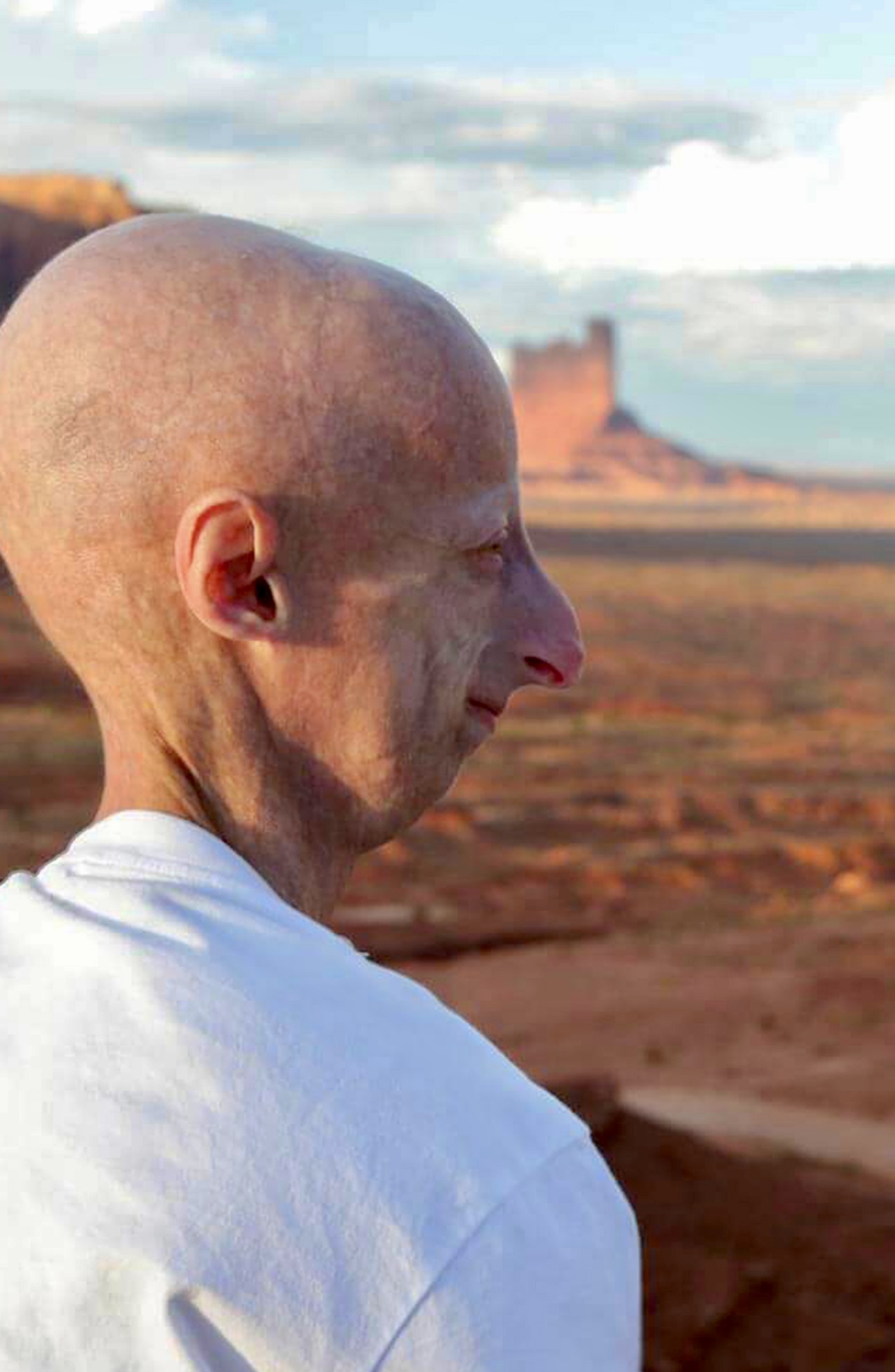 Sammy Basso, morto a 28 anni: il simbolo della lotta contro la progeria lascia un’eredità di speranza e ricerca